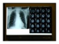 medicdirect X-Ray